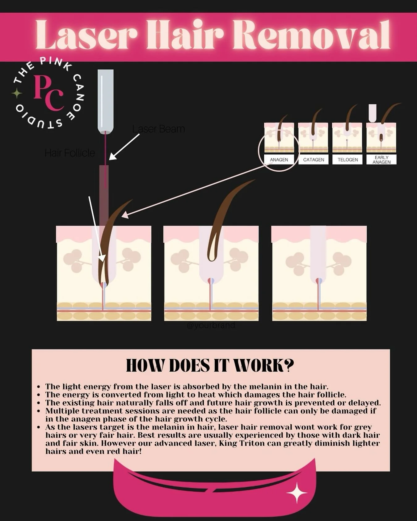 ✨ Smooth skin starts long before summer ✨

Tired of shaving every single day? 🙅&zwj;♀️
Laser hair removal at The Pink Canoe Studio can give you smooth, hair free skin in as little as 4 to 8 treatments.

Each session means:
🪒 Less shaving
🚫 No more