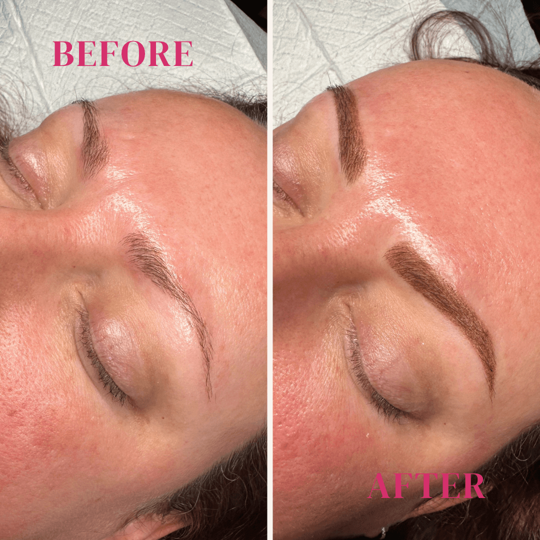 Before after minimal skincare Instagram post (1).png