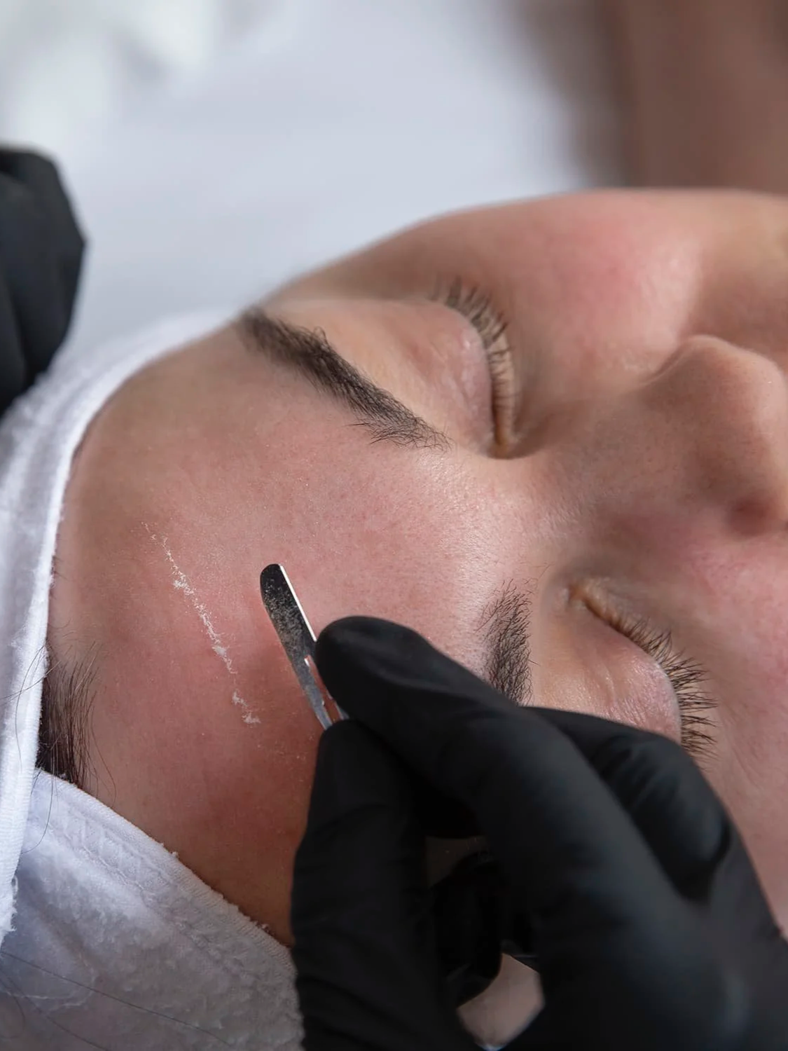 A person with closed eyes receiving a derma planing treatment on their forehead using a handheld tool with a white abrasive tip, while wearing a white headband and black gloves.