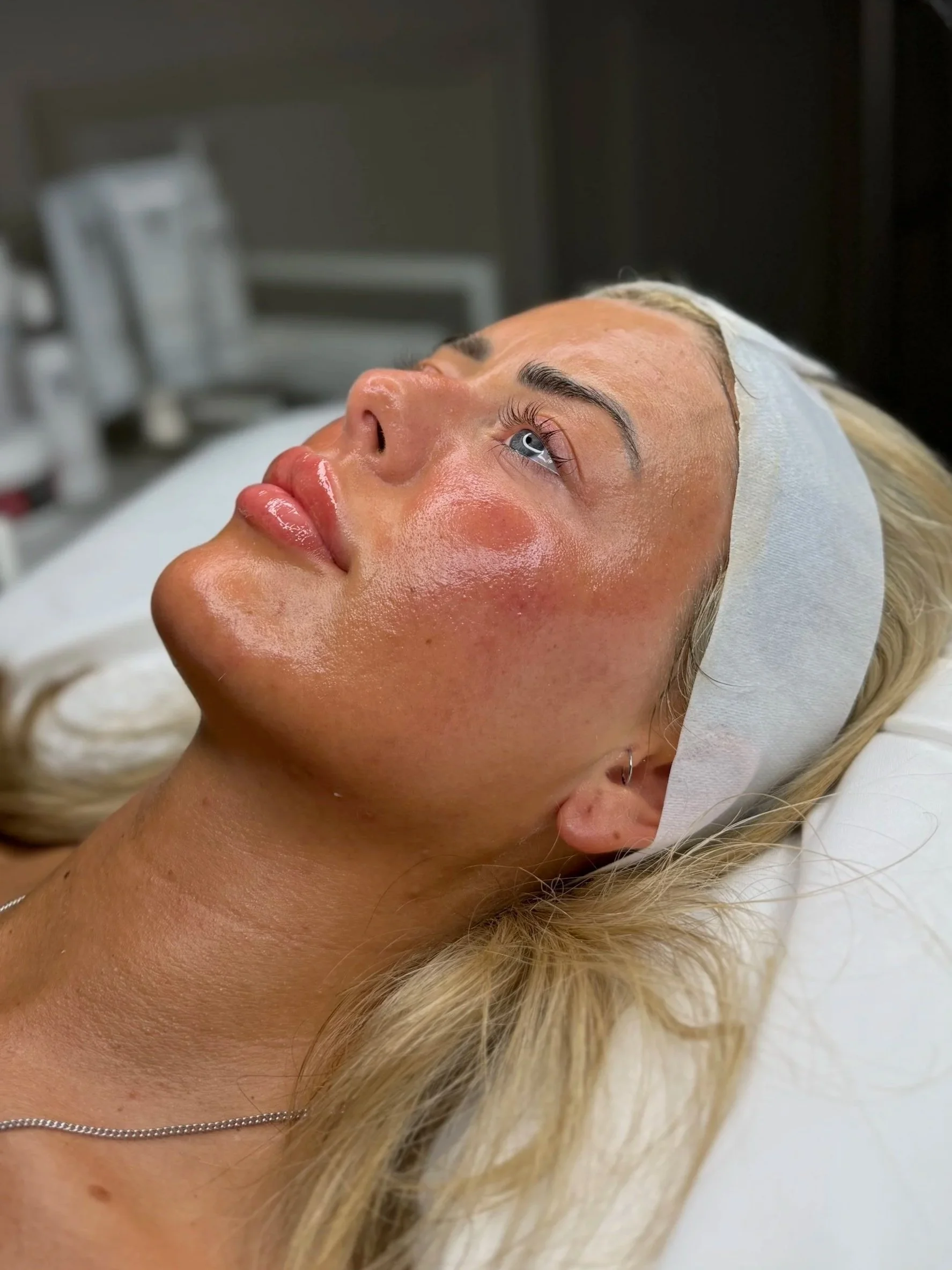 A woman with blonde hair lying on a medical bed, receiving a skincare treatment. She has a headband, and her face appears shiny and freshly treated.
