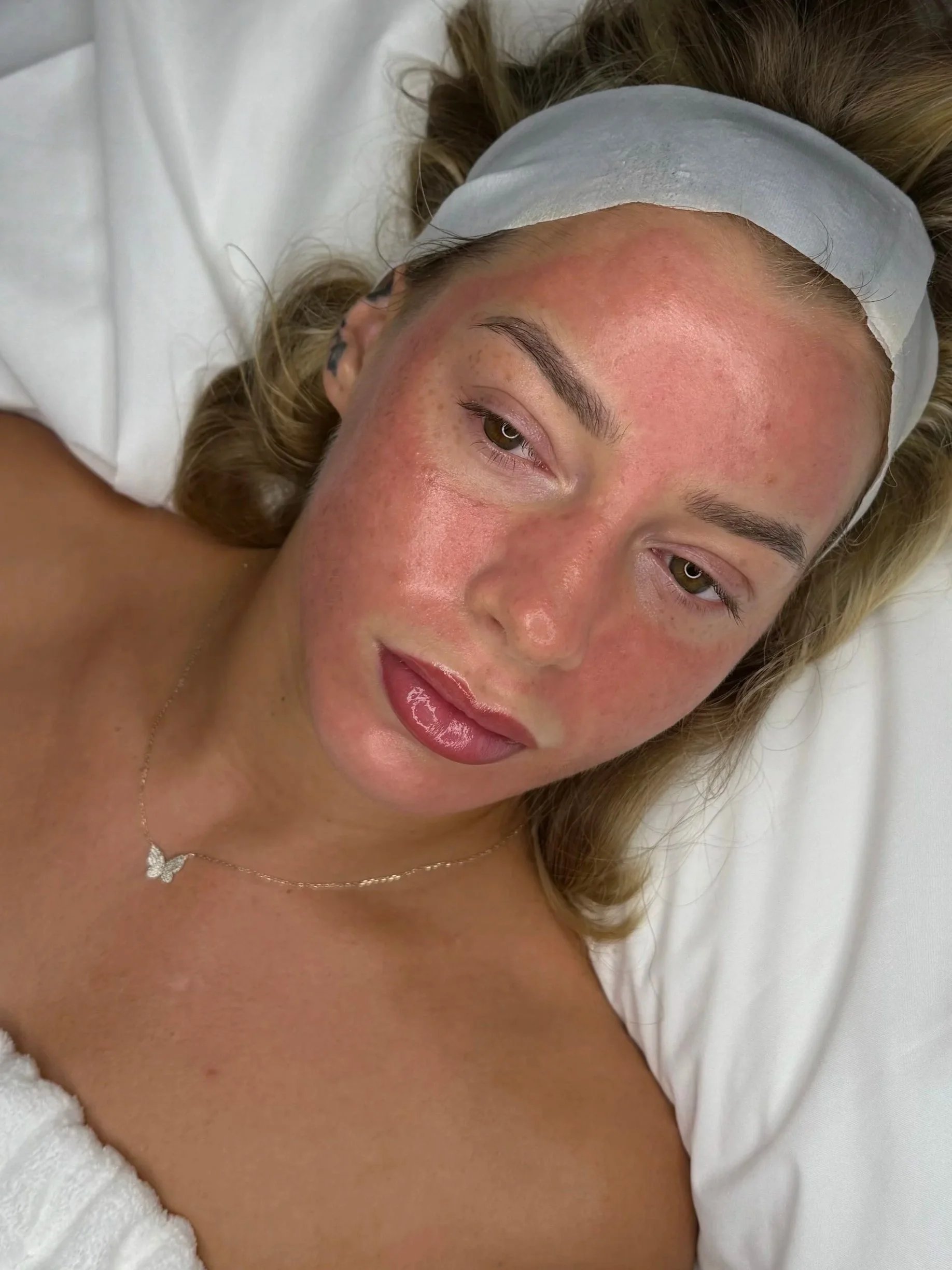 A woman with a red glow on her face, lying in a bed with a white headband and a butterfly necklace.