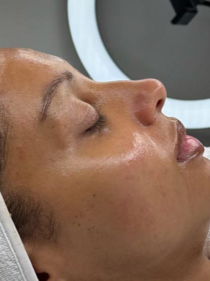 Close-up of a woman's face with eyes closed, receiving a skincare treatment or facial, in a clinical setting.