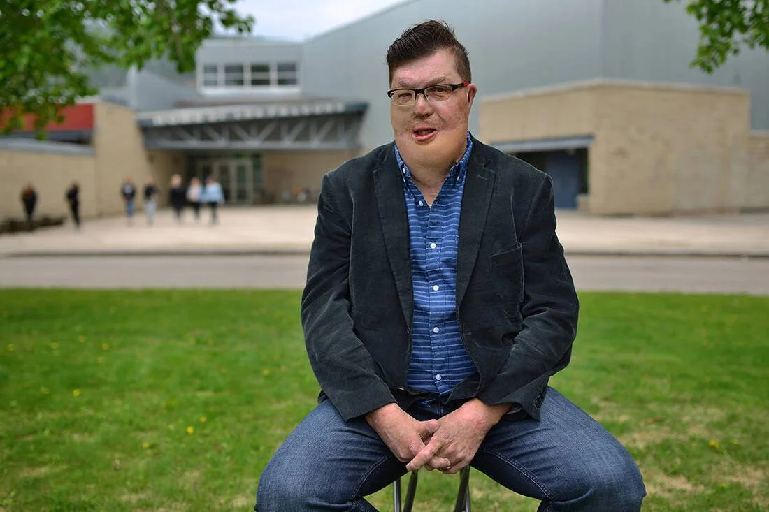 A young man with glasses, short dark hair, and freckles sitting on a stool on a grassy area, making a funny face with his tongue out. He is wearing a dark blazer, a blue striped shirt, and jeans. In the background, there is a modern building and a fe