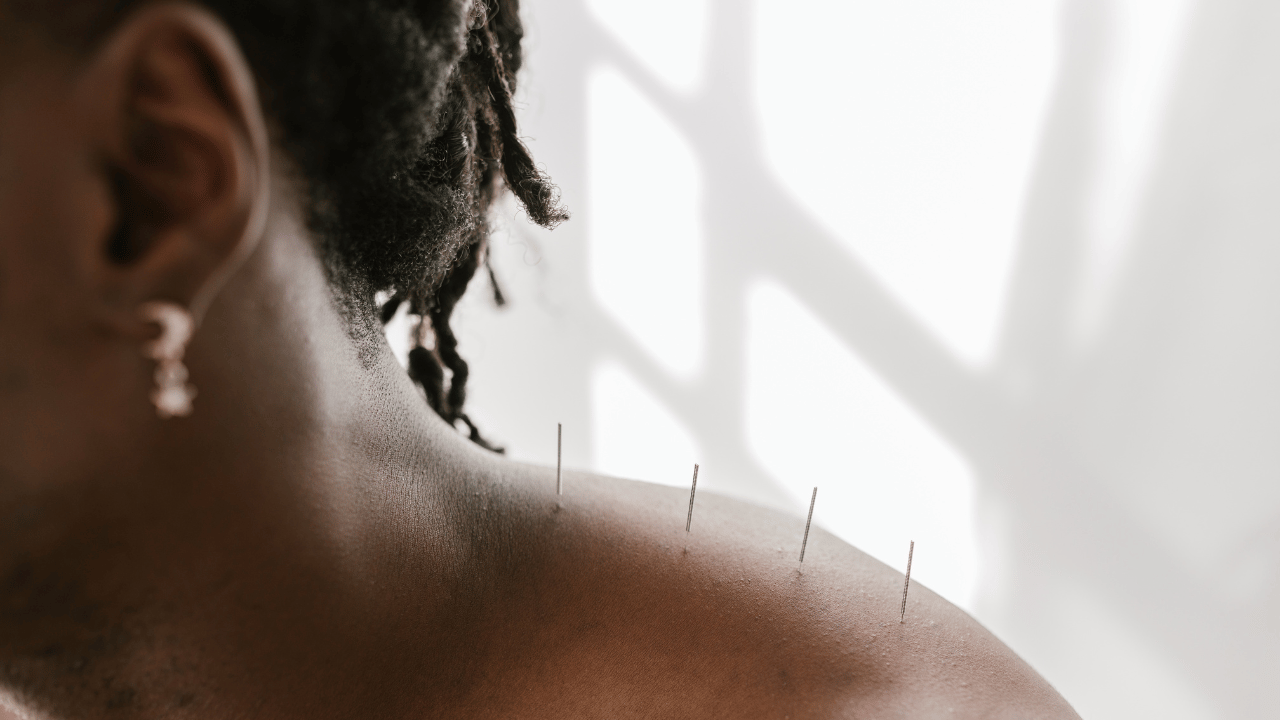 Finding Calm: How Acupuncture and Herbal Medicine Work Together to Ease Stress and Anxiety