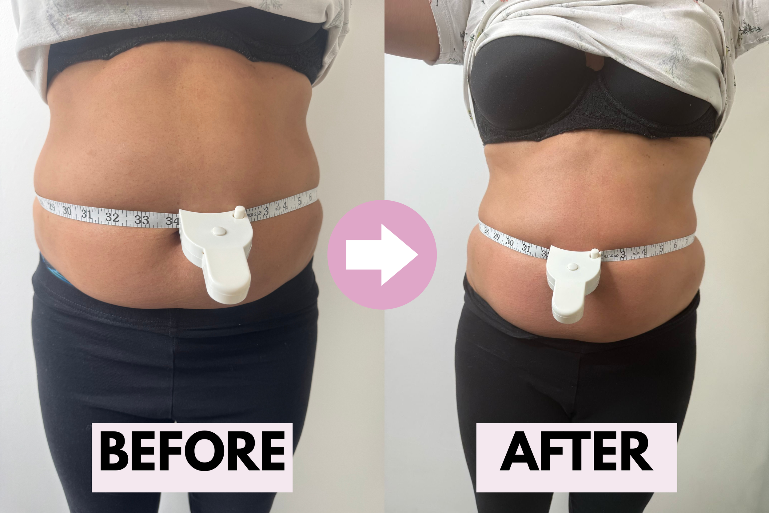 Before and after photo showing a visible reduction in waist size after body contouring treatments.