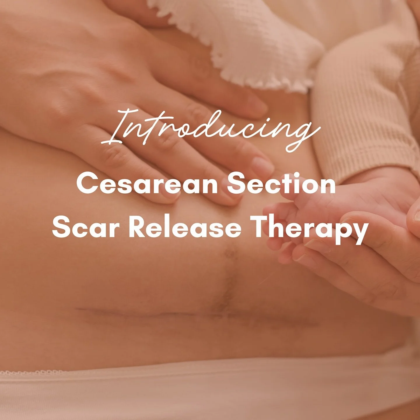 ✨ NEW SERVICE ALERT ✨
 Still feeling tension or discomfort from your C-section scar&mdash;even months or years later? You&rsquo;re not alone.

We&rsquo;re now offering C-Section Scar Release Therapy 💛
 Gentle, non-invasive, and focused on so much mo