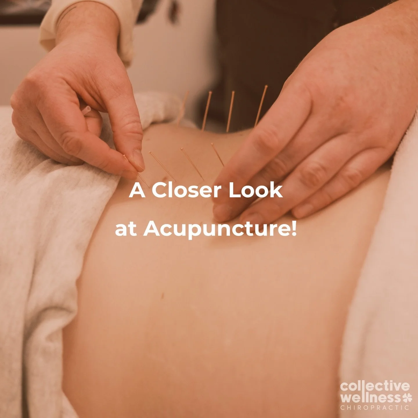Have you been curious about acupuncture, but feel like you don&rsquo;t know enough about it?

Acupuncture is a safe, gentle form of care that can be helpful when pain feels acute, sharp, or too sensitive for hands on care. Dr. Lexi uses Western Medic
