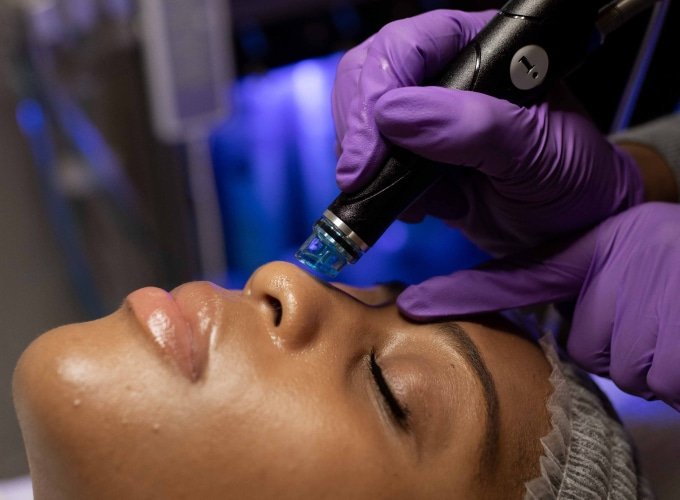 hydra facial, hydradermabrasion, microblading, ombre powder brows, glowing facials, glowing skin, acne facial, anti aging facial, skin rejuvenation, facial in royal oak, facial in gross pointes, facial in Ferndale, beauty facials, beauty deals,