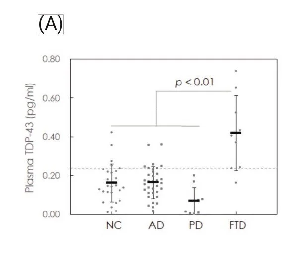 A box plot comparing plasma TDP-43 levels among four groups labeled NC, AD, PD, and FTD, with FTD showing the highest levels and a statistically significant difference (p < 0.01).