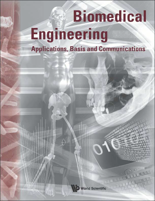 Immunomagnetic reduction for fetal fibronectin detection - A novel method to detect the preterm biomarker