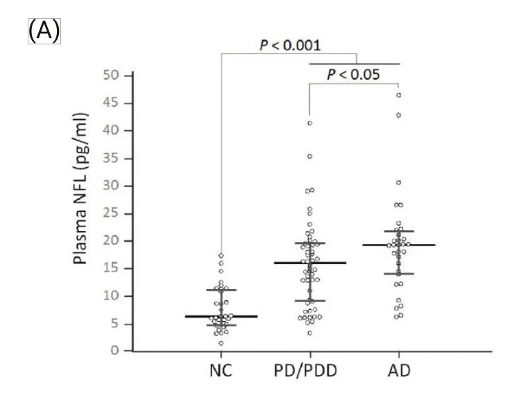 Scatter plot showing plasma NFL levels in three groups: NC, PD/PDD, and AD, with statistical significance indicated between groups.