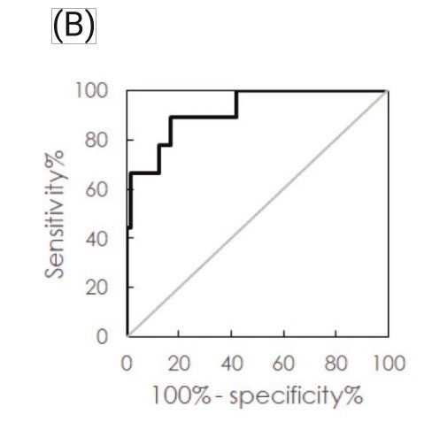 Receiver operating characteristic (ROC) curve showing sensitivity versus 100% specificity with a black stepwise line and a diagonal reference line.