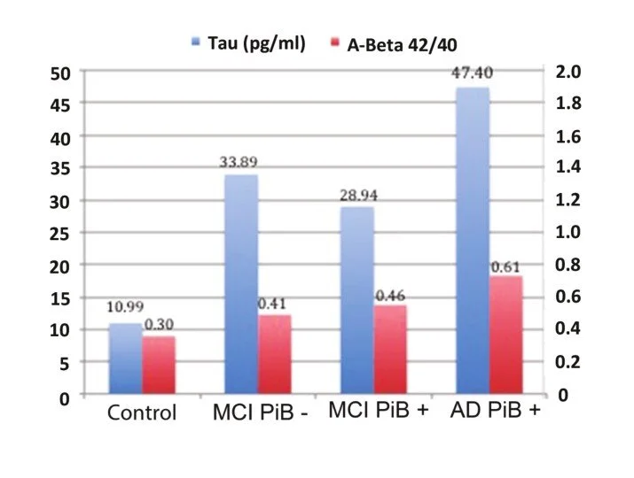 Bar graph comparing tau protein levels in pg/ml and A-Beta 42/40 ratios across four groups: Control, MCI PiB-, MCI PiB+, and AD PiB+. Tau levels increase from Control to AD PiB+; A-Beta ratios also increase across groups.
