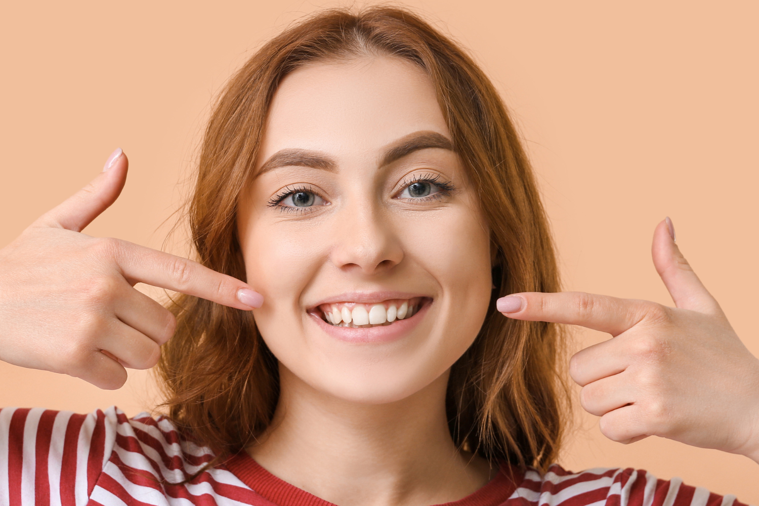 A young woman with red hair and a striped shirt smiling and pointing to her cheeks.