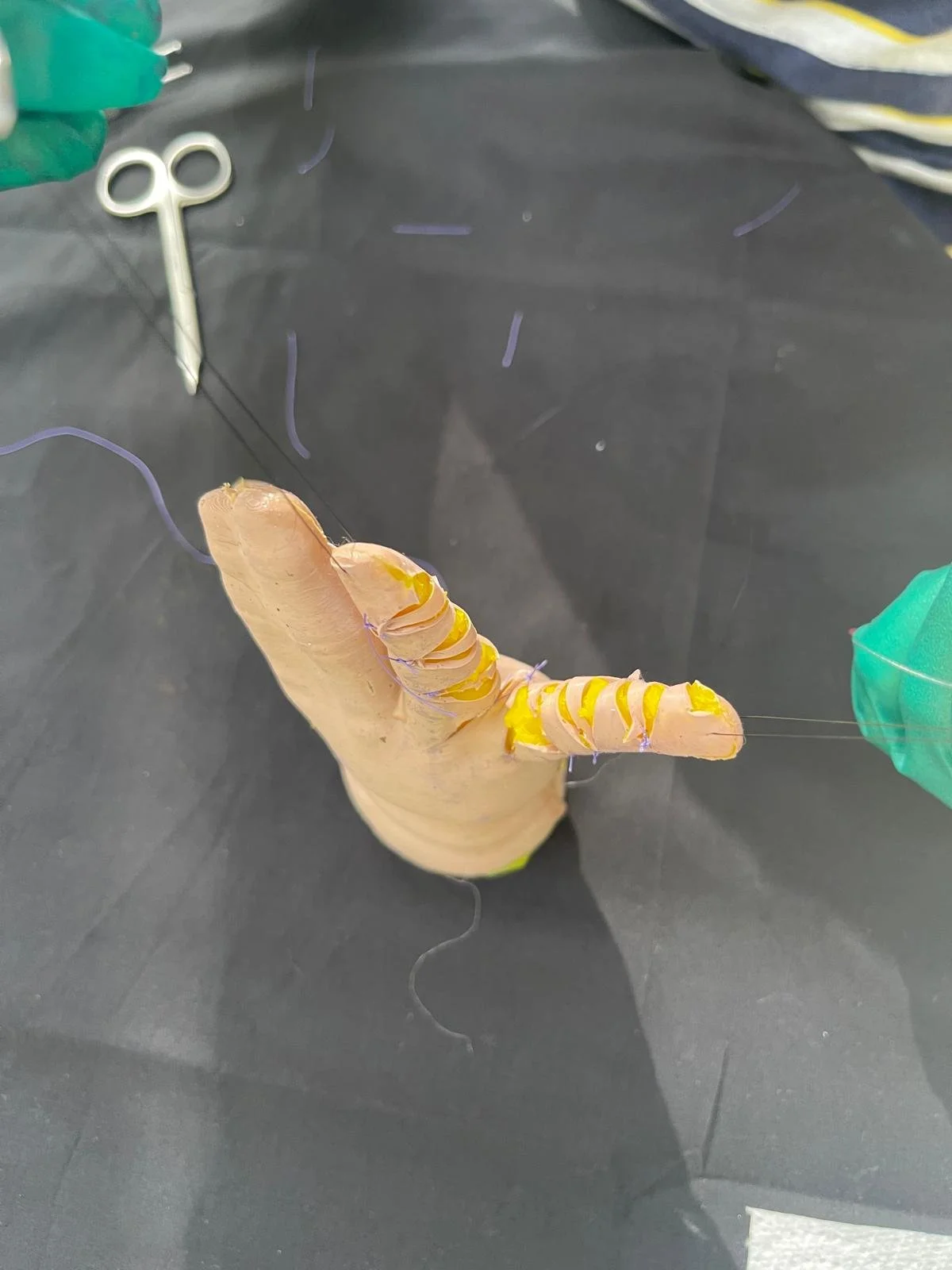 Image of the course in action. Surgical Sculpture – Syndactyly Surgery Course