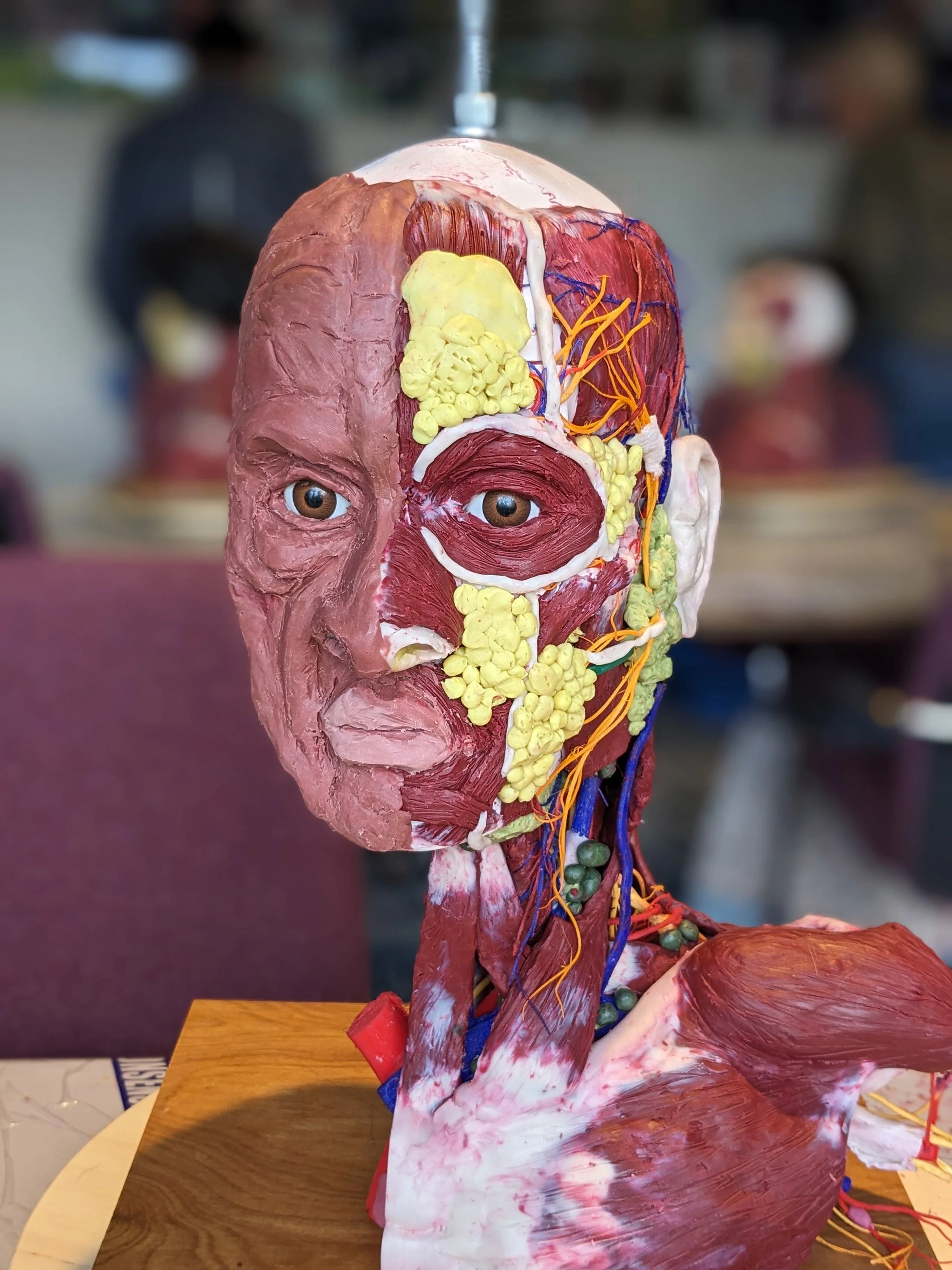 Image of the model. Surgical Sculpture – Facial Aesthetics Course