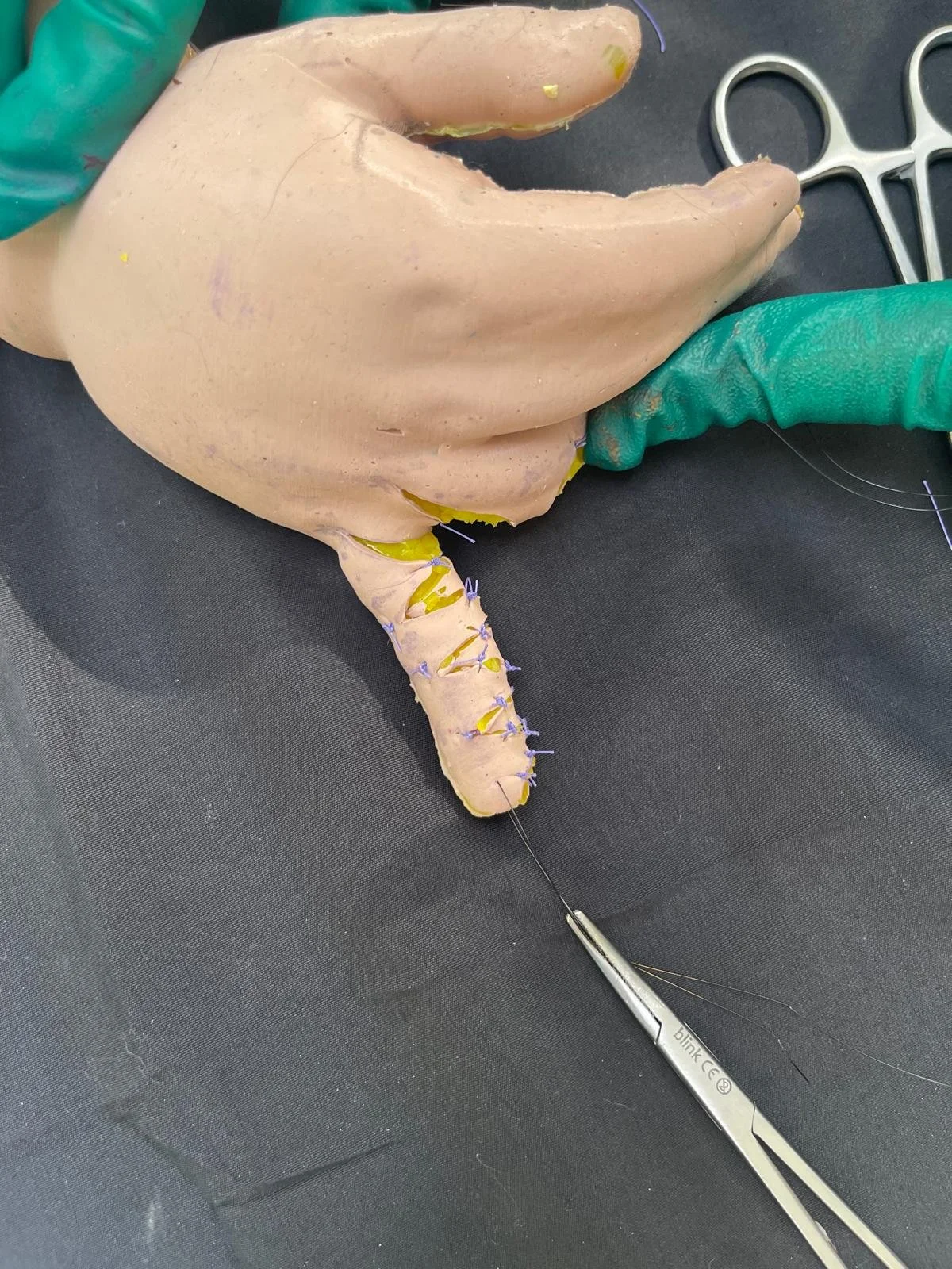 Image of the course in action. Surgical Sculpture – Syndactyly Surgery Course