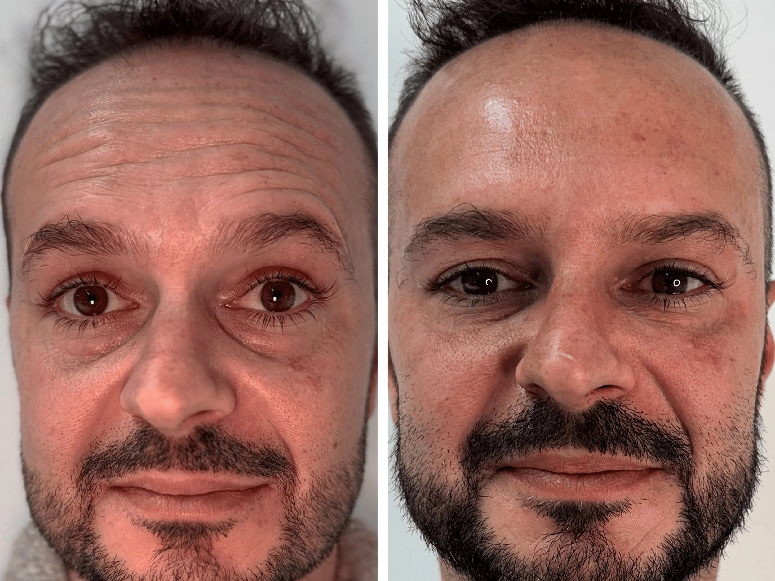 ANTES Y DESPUES.jpeg