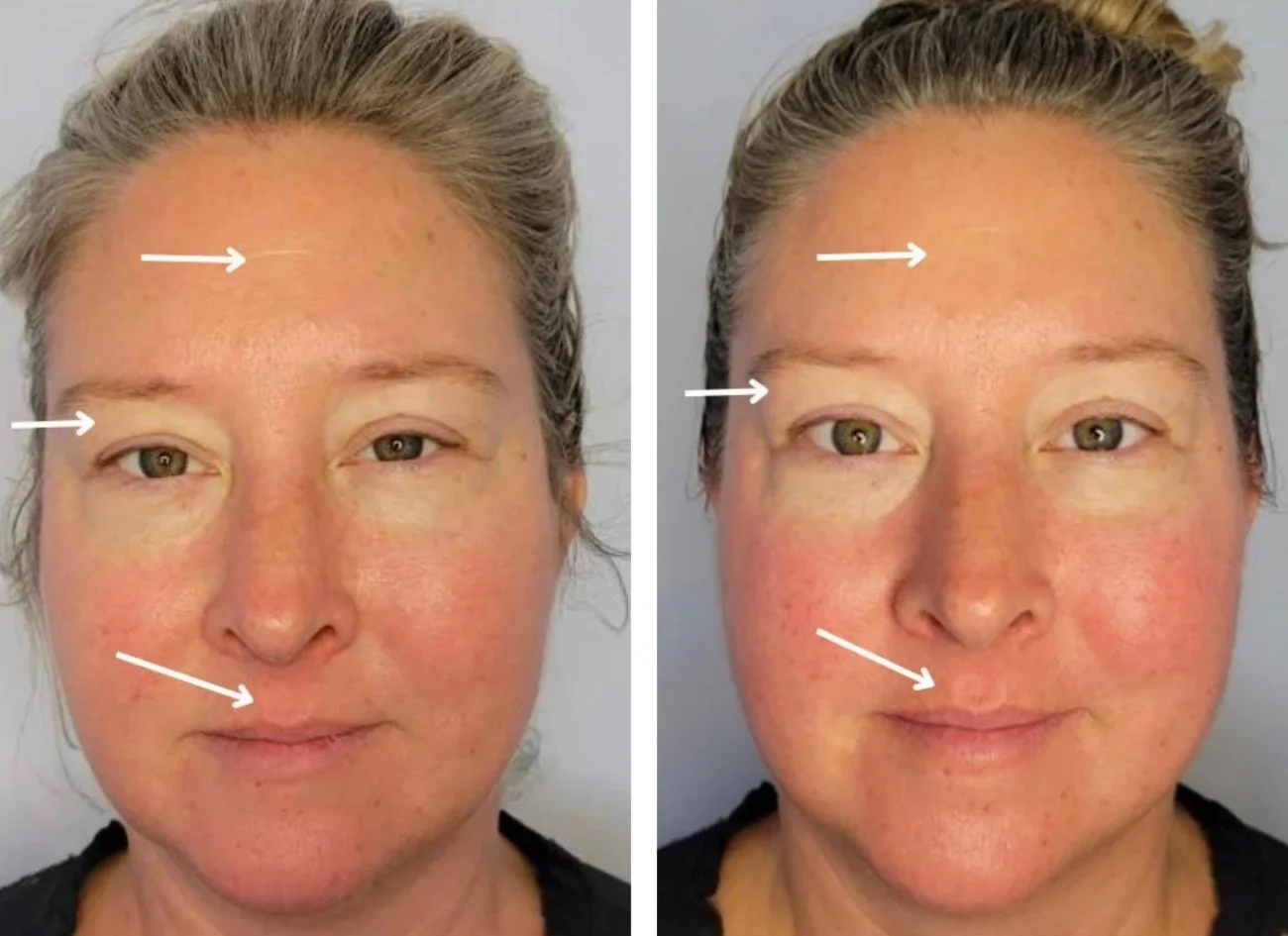 Before and after images of a woman's holistic facial from Urban Holistic in Hamilton, Ontario