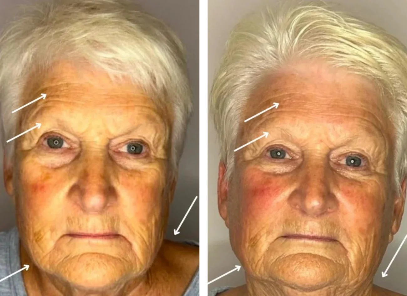 Before and after images of a woman's holistic facial from Urban Holistic in Hamilton, Ontario