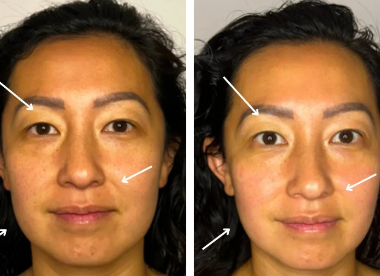 Before and after images of a woman's holistic facial from Urban Holistic in Hamilton, Ontario