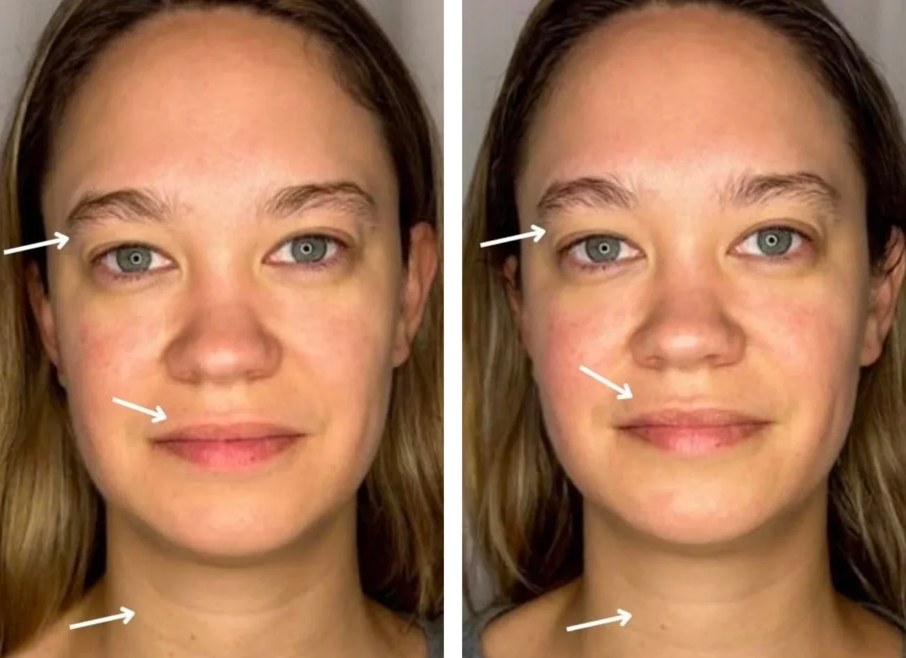 Before and after images of a woman's holistic facial from Urban Holistic in Hamilton, Ontario