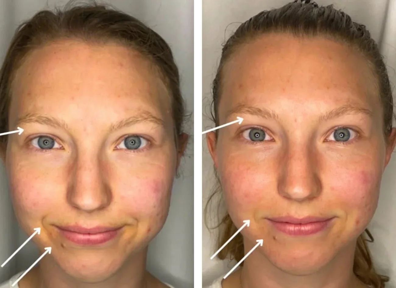 Before and after images of a woman's holistic facial from Urban Holistic in Hamilton, Ontario