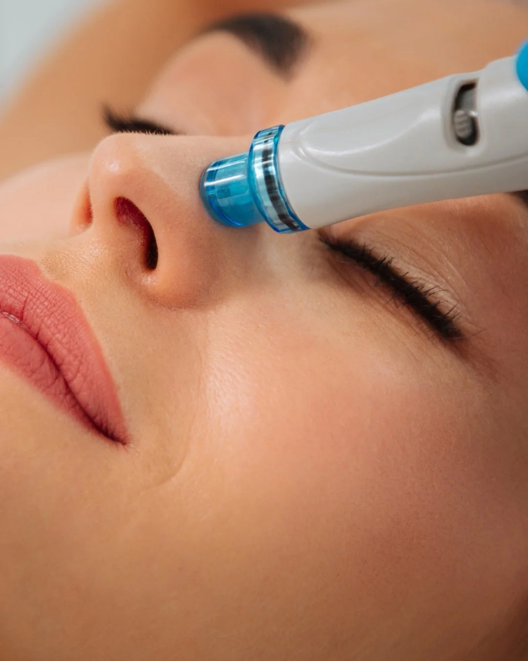 hydrafacial-near-me-scottsdale-85258