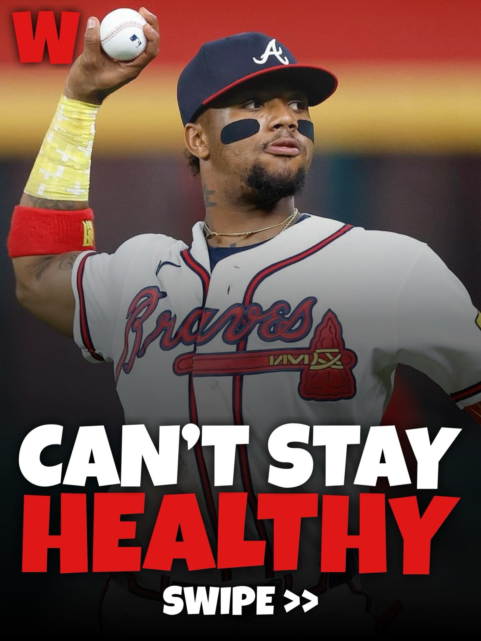 Ronald Acuńa Jr. is one of the games most exciting players, but he can&rsquo;t seem to stay on the field lately 😔 

Acu&ntilde;a just suffered another apparent leg injury this week after already missing extended time in May. Hopefully it&rsquo;s min