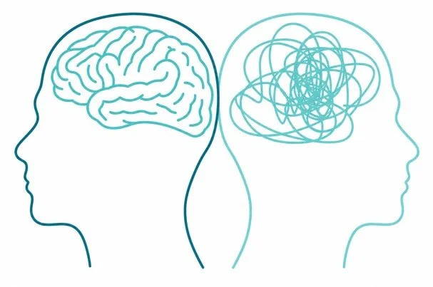 brain-while-anxious