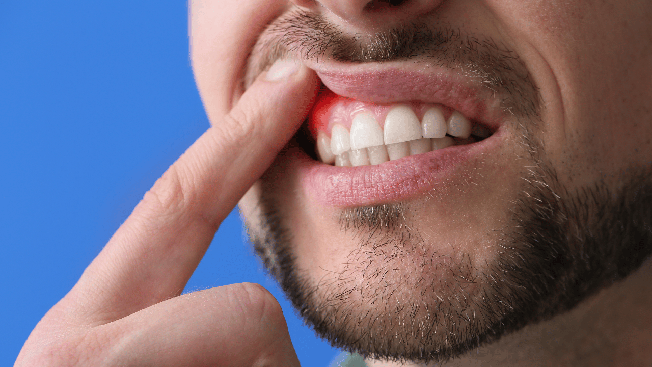 The Link Between Gum Disease and Systemic Health
