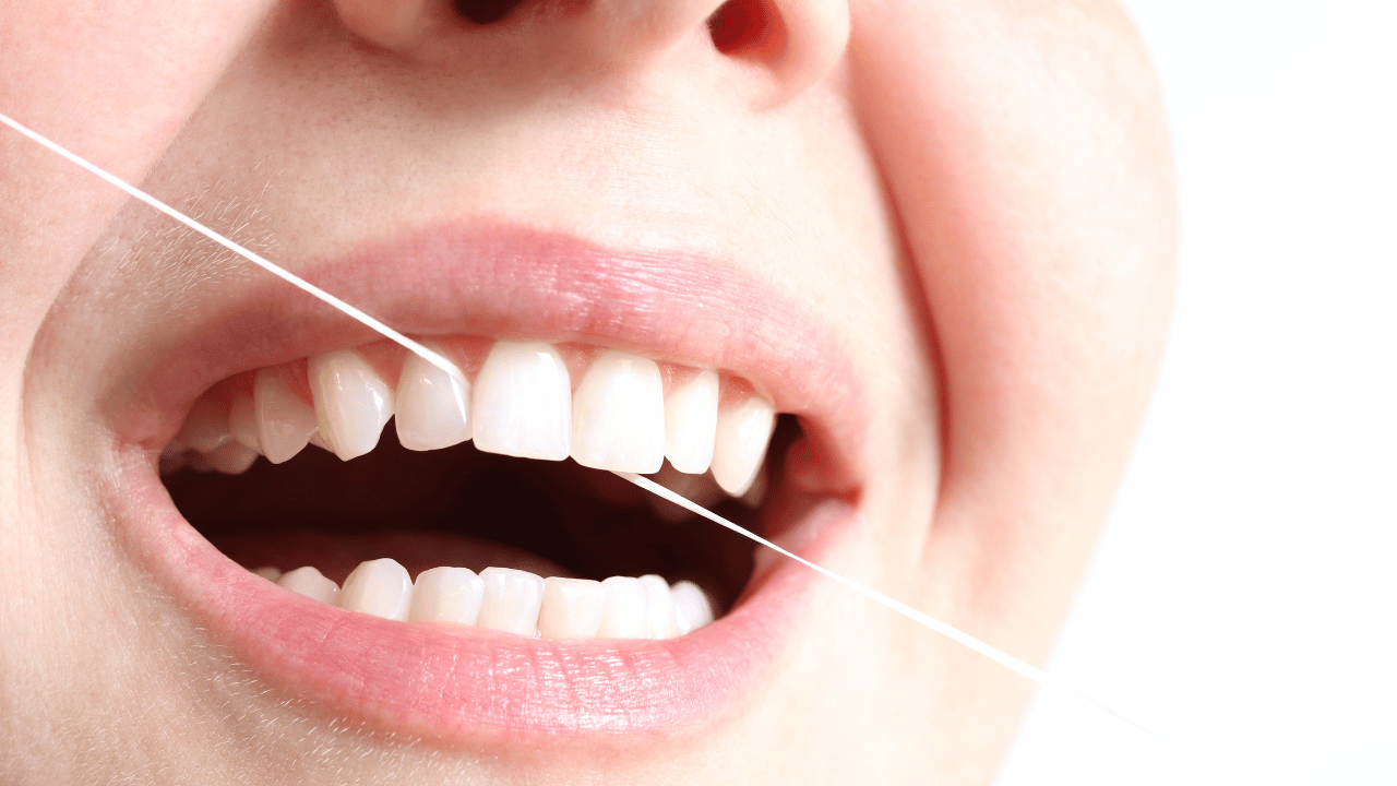 The Best Techniques for Threading Floss with Braces