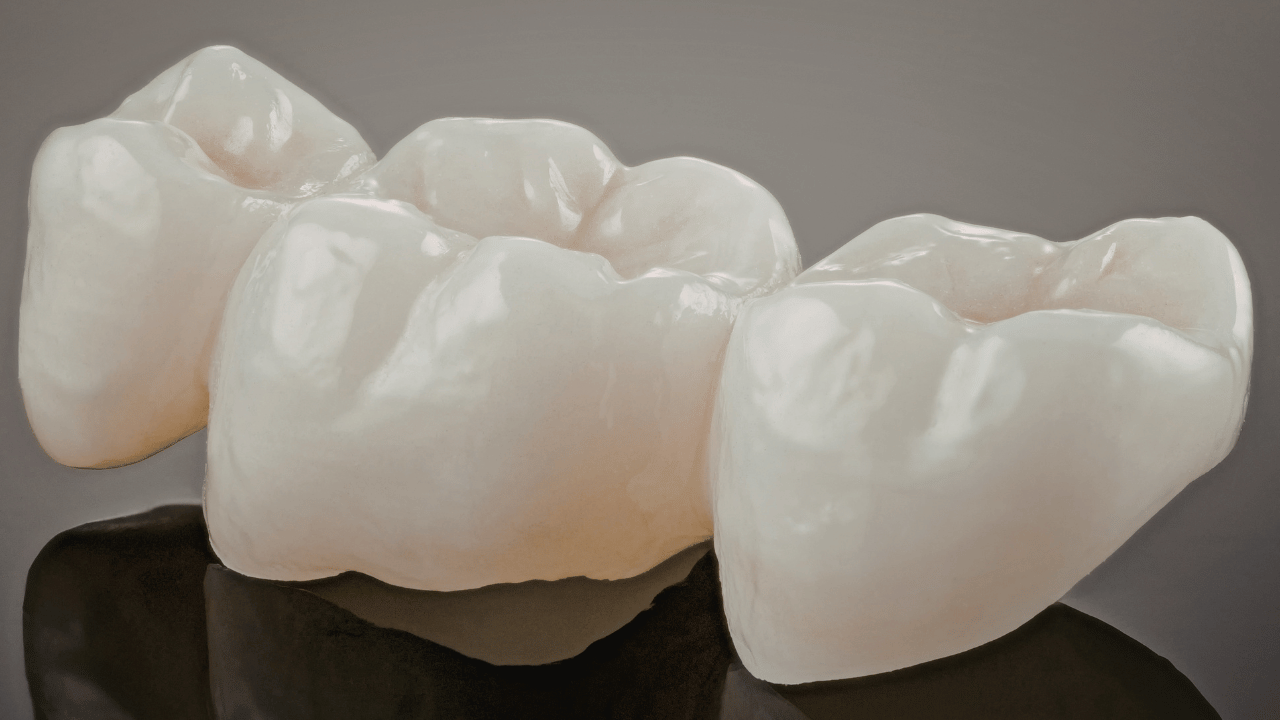 Experience Fast &amp; Convenient CEREC Crowns in Tulsa Today