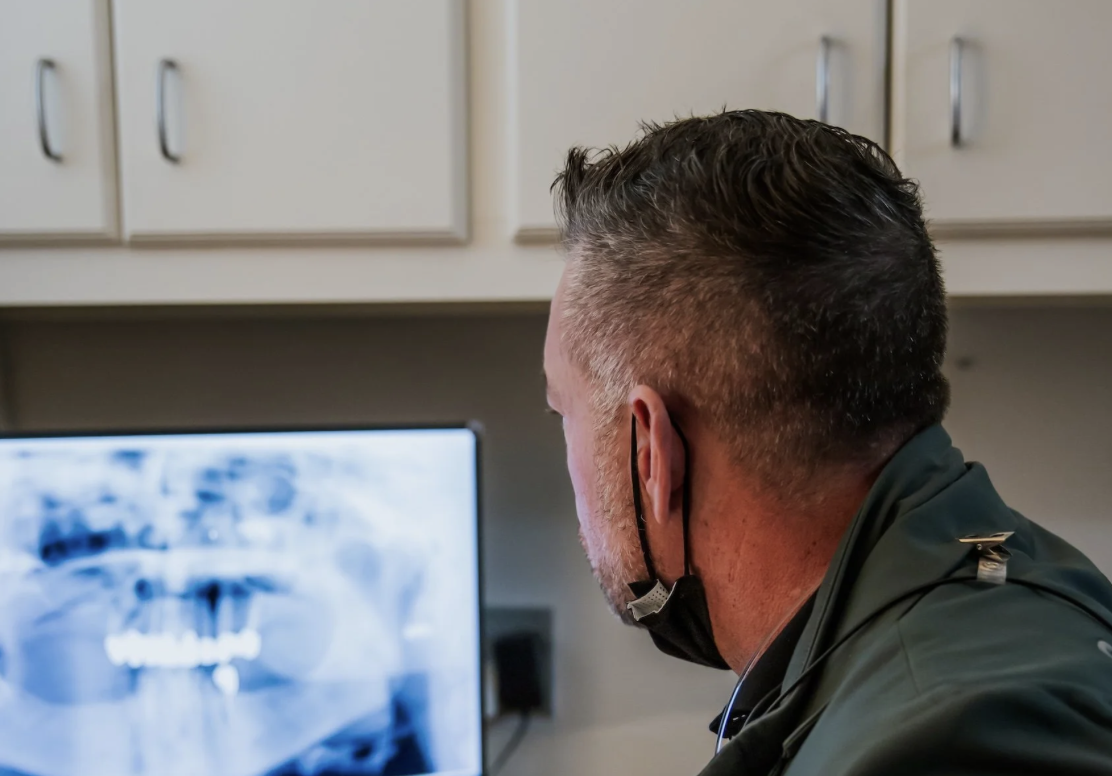 Am I a Candidate for All-on-4 Implants?