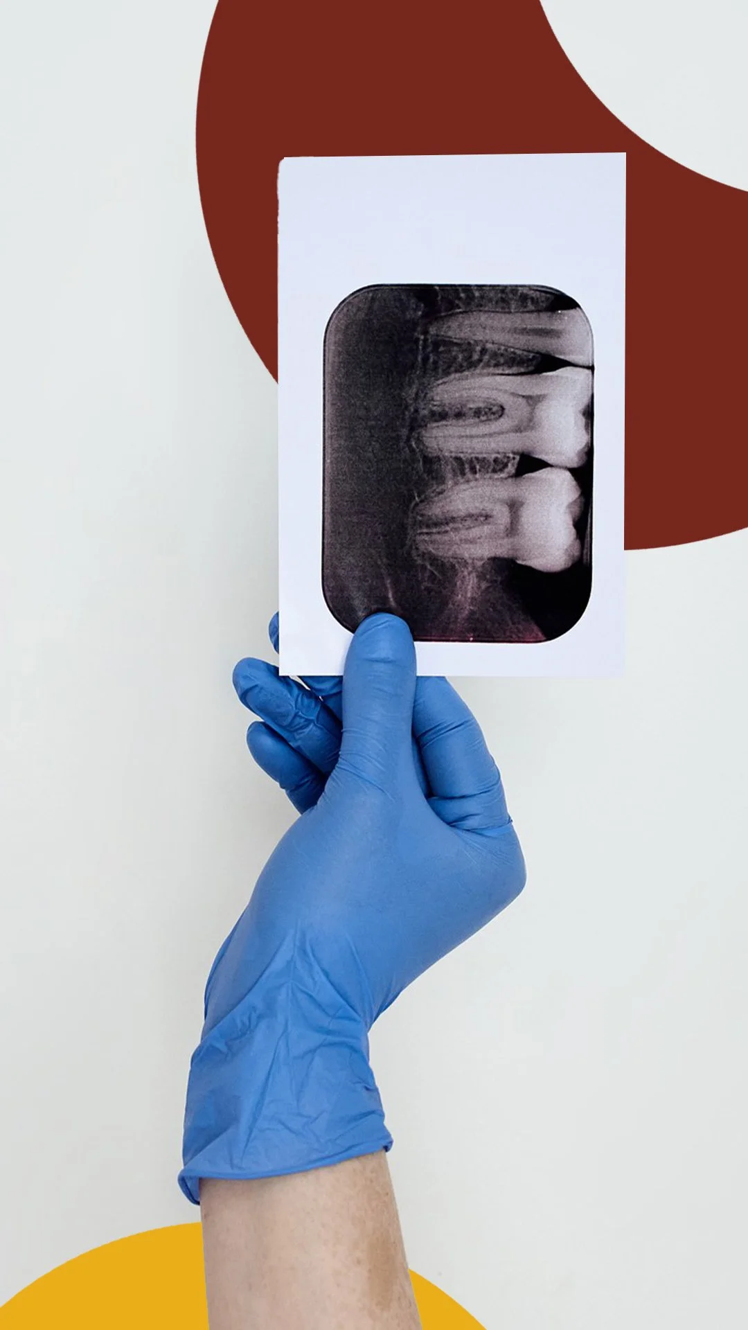 Gloved hand holding dental X-ray over abstract background