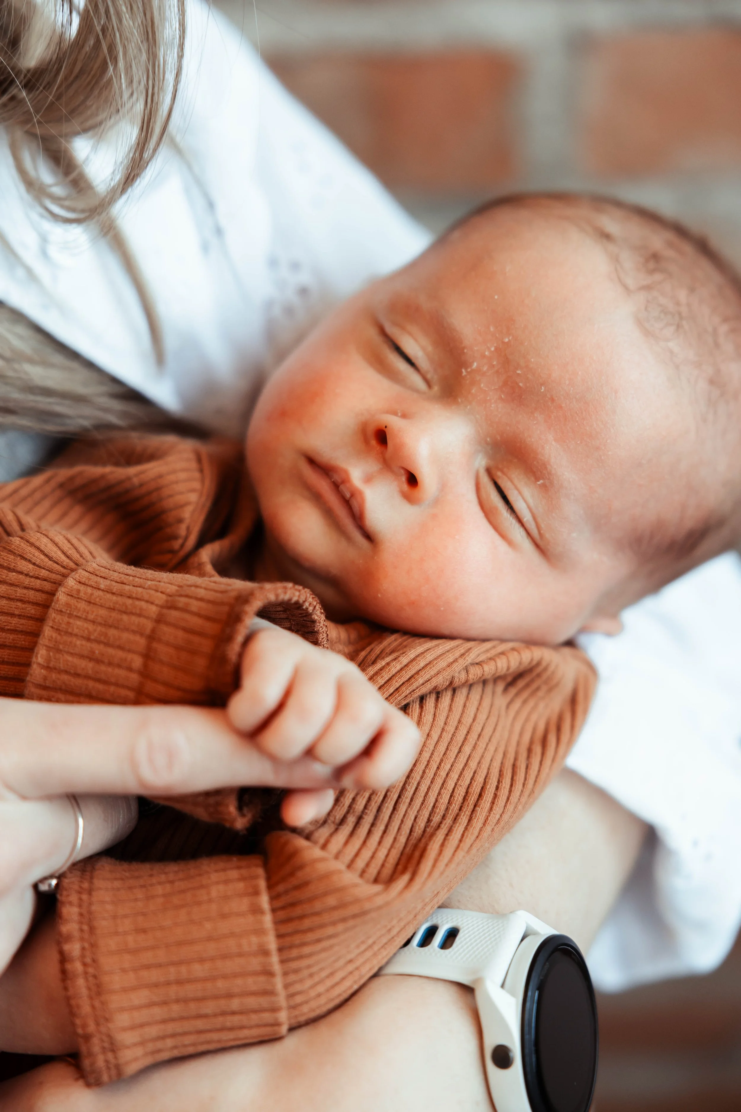 Jaundice: What it is and When to Worry