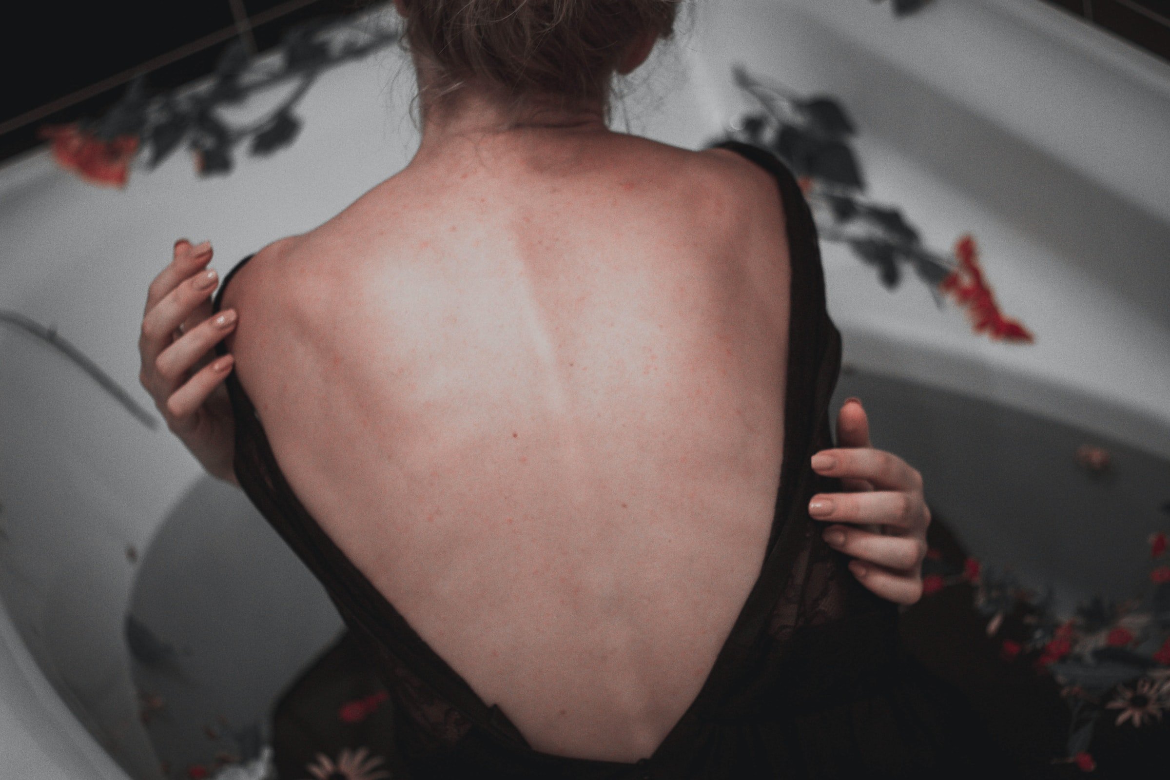 Como prevenir a hérnia discal