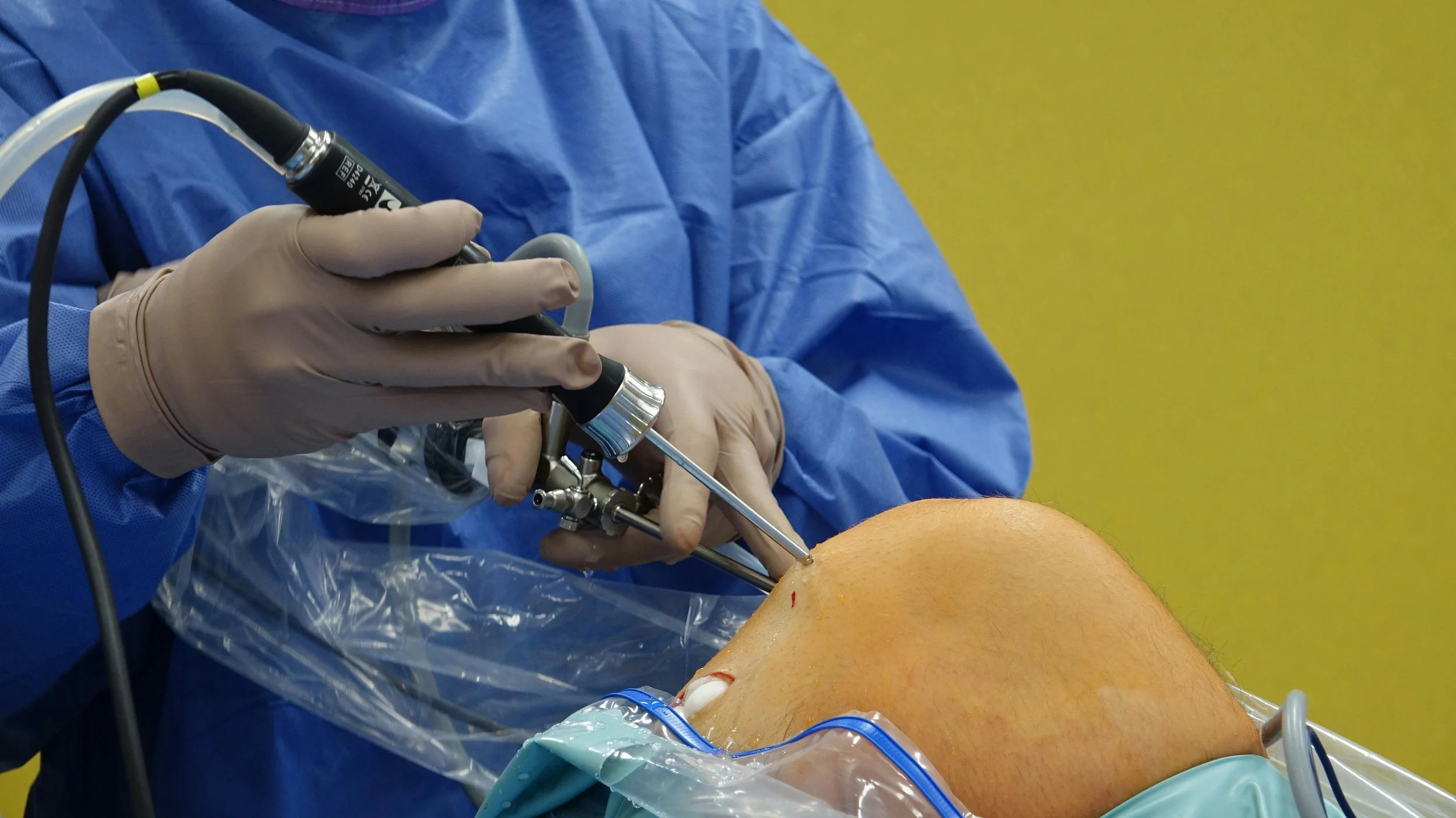 ACL Rehab Isn’t What It Used To Be — Here’s What Actually Gets You Back to Sport Faster