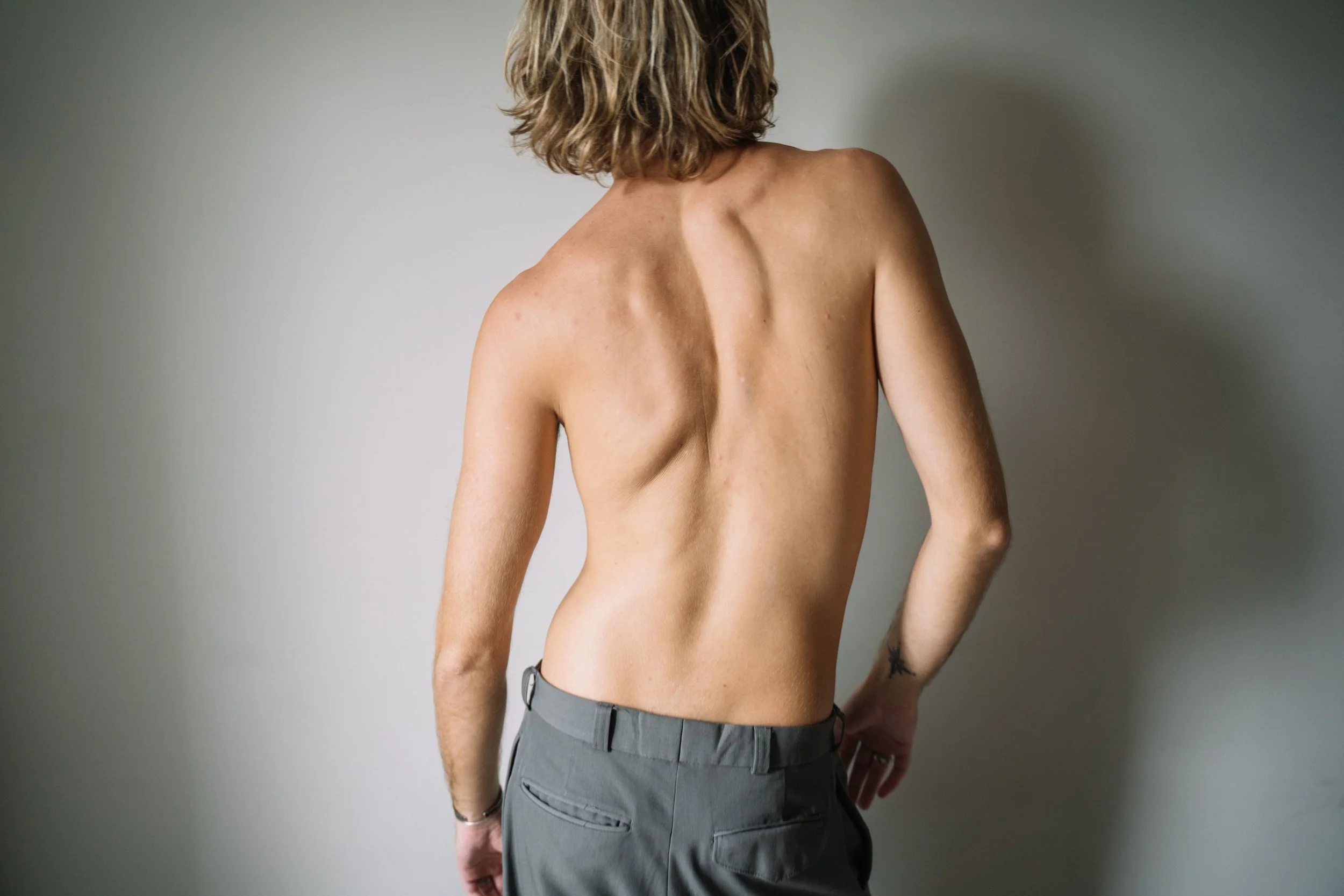 Scoliosis: Signs Every Parent Should Know
