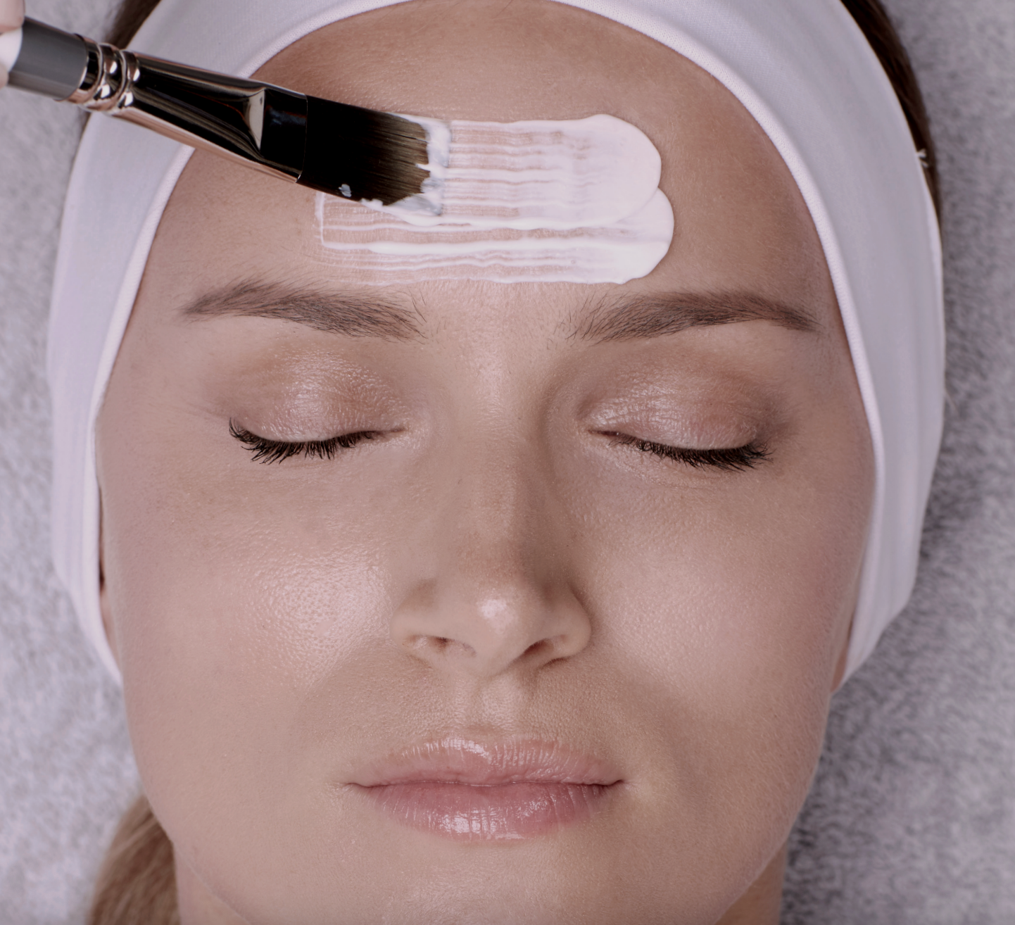 No down-time chemical peels