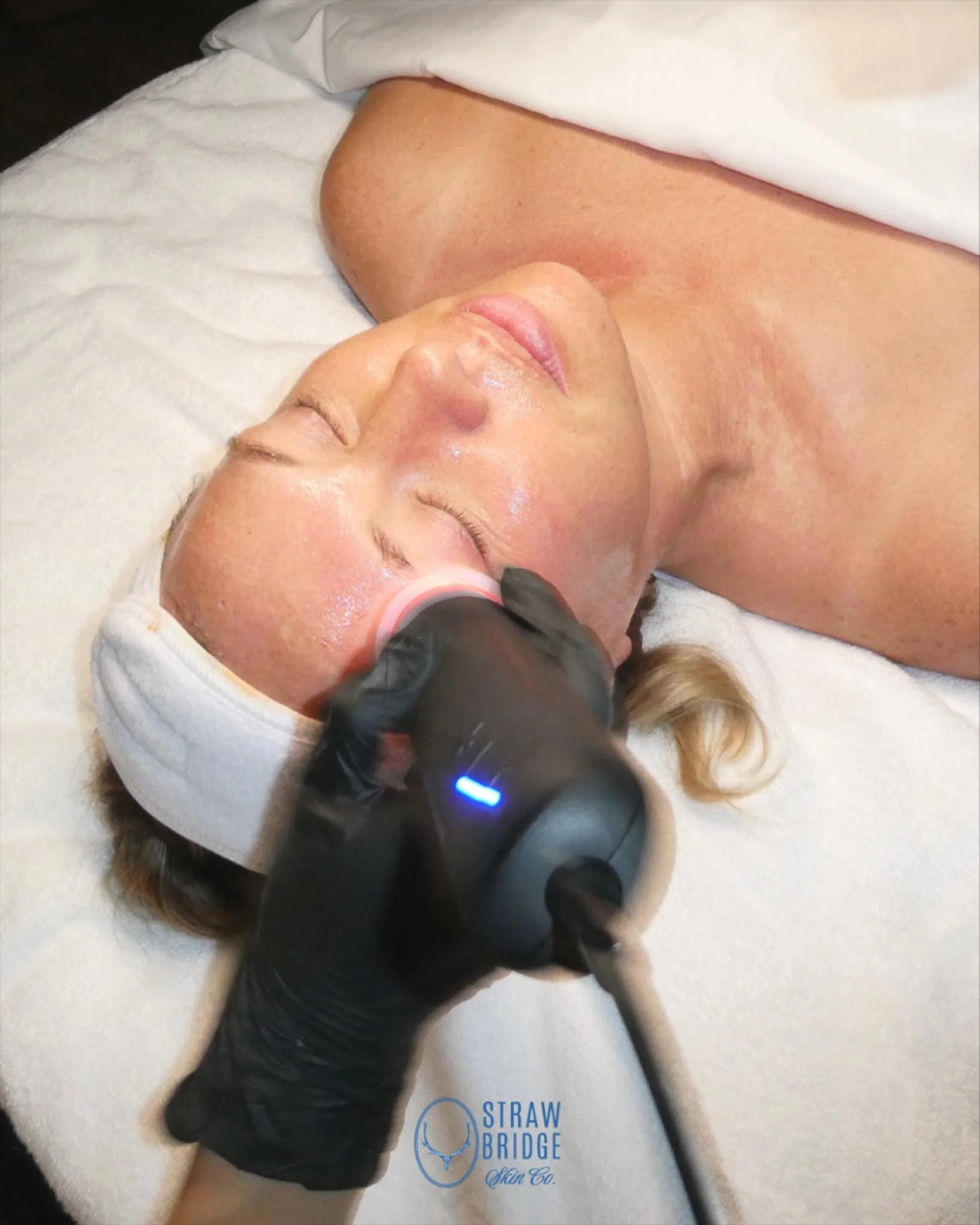 a client favorite when it comes to depuffing &amp; sculpting 🫧🤍

When we do not get proper lymphatic drainage, we can see our skin appear more dull, congested and swollen. Therefore, we utilize the Glo2Facial hand-piece to help detoxify the skin an