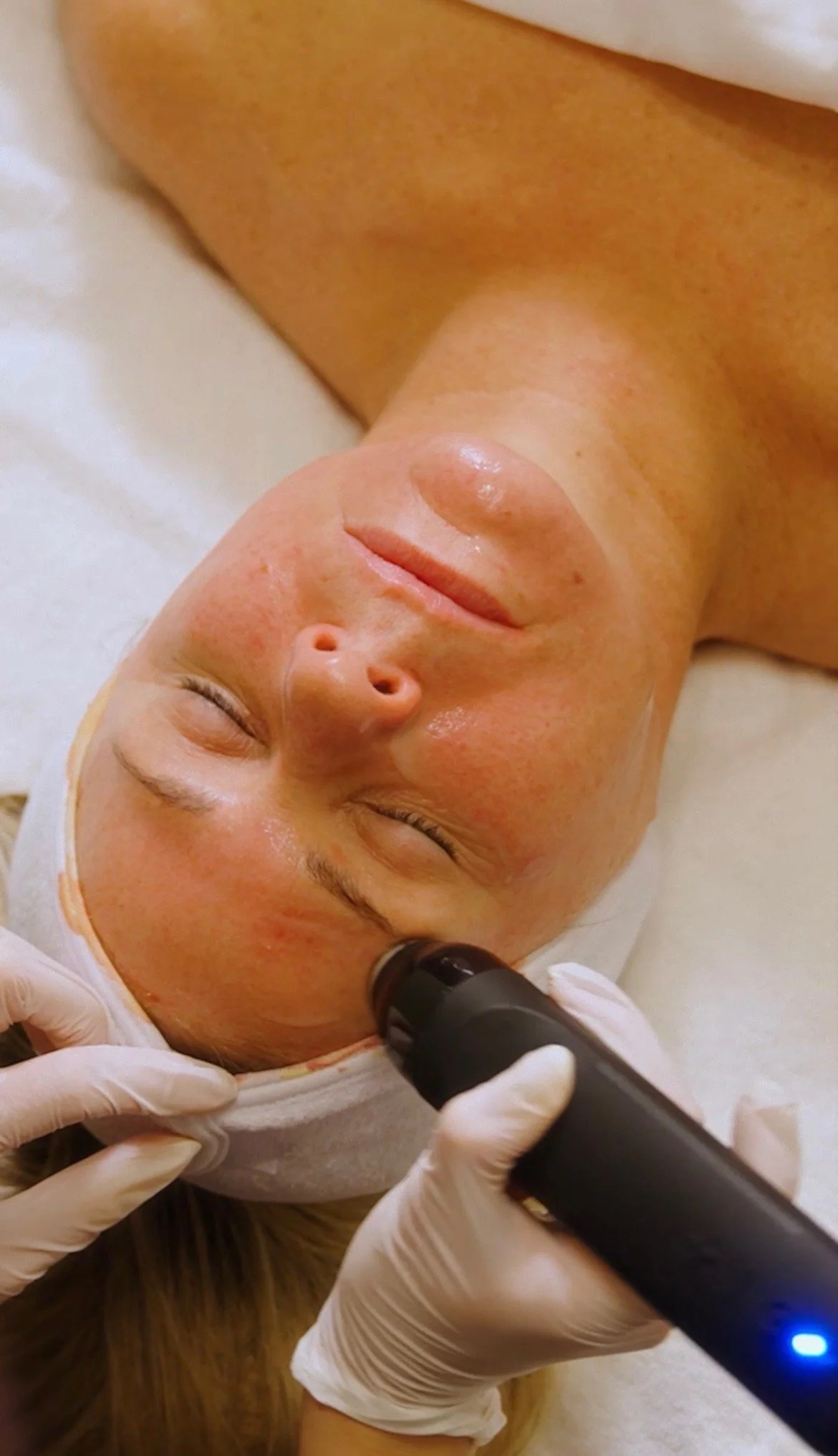 Glo2Facial: Oxygen Facial