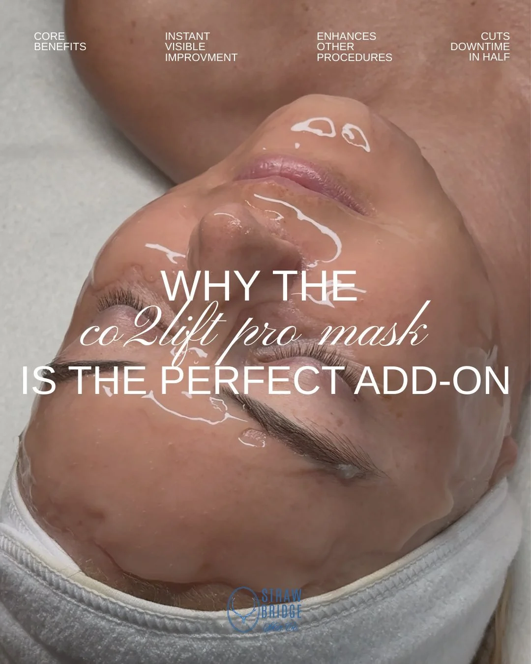 This is the step that optimizes your treatment results✨

The CO2Lift Pro Gel Mask delivers deep oxygenation, intense hydration, and instant calming &mdash; helping your skin heal faster &amp; glow effortlessly. 

This is the add-on that refines resul