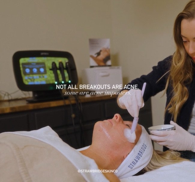 Stop treating these conditions like acne&mdash;it&rsquo;s slowing down your results.

Here a few of my favorite barrier supporting products to target each condition
+ rosacea acne &mdash; Epicutis lipid serum, SIV, CO2Lift moisturizing mousse
+ kerat