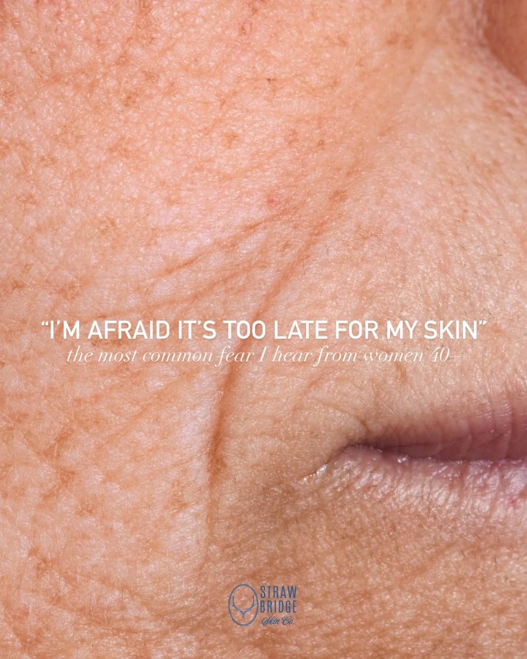 it&rsquo;s never about reversing time. It&rsquo;s about restoring function. 

&ldquo;I&rsquo;m afraid it&rsquo;s too late for my skin&rdquo; is something I hear all the time. But the skin is living tissue, and living tissue responds to the right stim