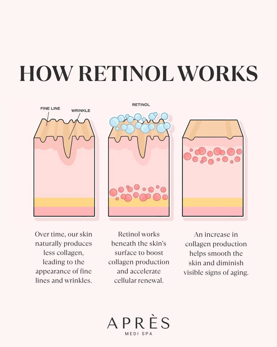 Smoother, brighter, younger-looking skin starts with collagen ✨

Our collagen-boosting treatments help reduce visible signs of aging and restore your skin&rsquo;s natural glow.

#ApresMedispa #CollagenBoost #YouthfulSkin #SkinRejuvenation #Microneedl