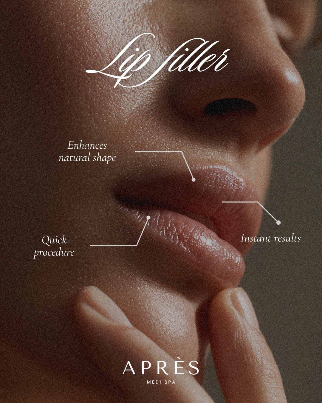 Subtle enhancement. Instant confidence. ✨

Lip filler is designed to enhance your natural shape, deliver immediate results, and fit seamlessly into your day with a quick, comfortable treatment.

Book your personalized lip consultation at Apr&egrave;s