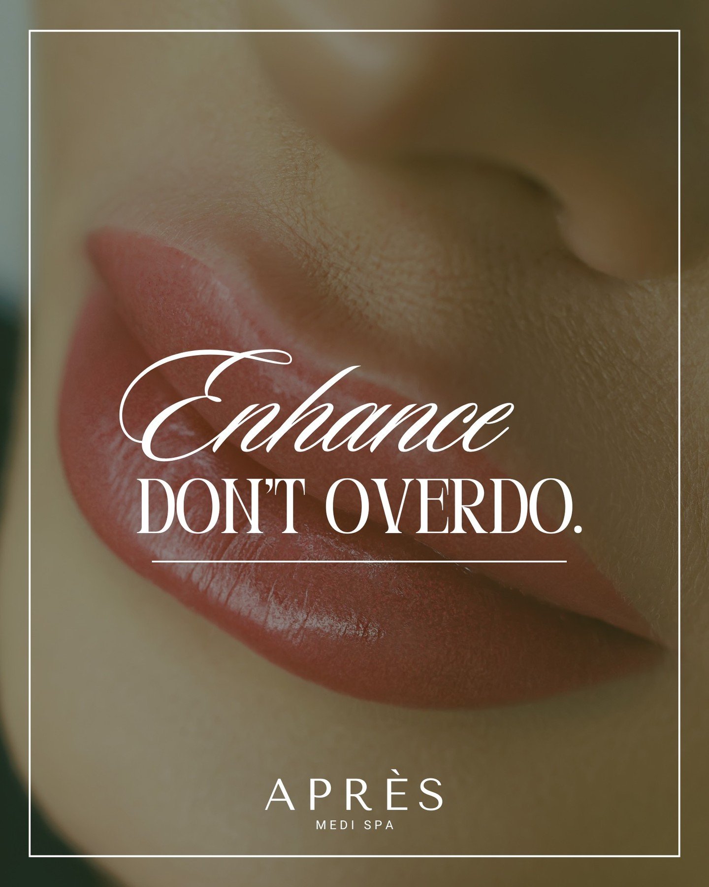 Subtle. Sophisticated. Stunning. At Apr&egrave;s, we believe in enhancing what&rsquo;s already beautiful &mdash; never overdone ✨ 

Thoughtfully placed filler for lips that feel as good as they look.

#ApresMediSpa #NaturalAesthetics #LipFiller #Moun