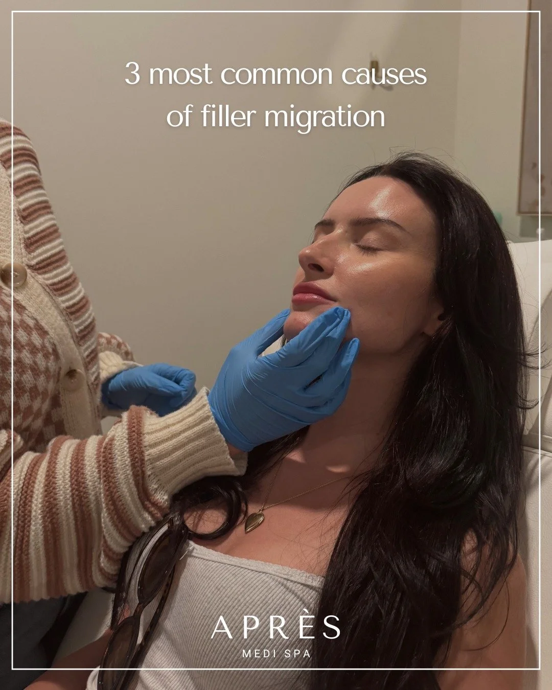 Filler migration isn&rsquo;t random&mdash;it&rsquo;s often the result of technique, placement, or product choice.

At Apr&egrave;s Medi Spa, we prioritize precision, balance, and anatomy-first treatments to ensure natural, long-lasting results.

#Apr