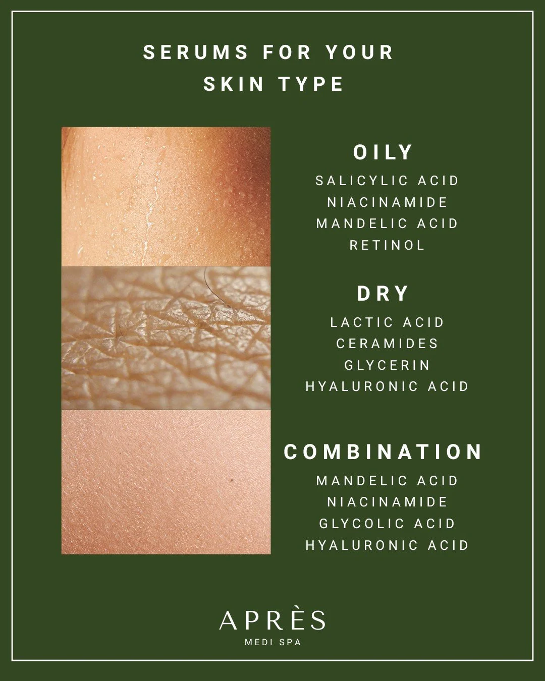Skin, but better ✨
Finding the right serum for your skin type makes all the difference!

#apresskin #skinroutine #skincareeducation #healthyskin #glowingskin #skintips #skincarecommunity #skincarelover #skinbarrier #hydratedskin